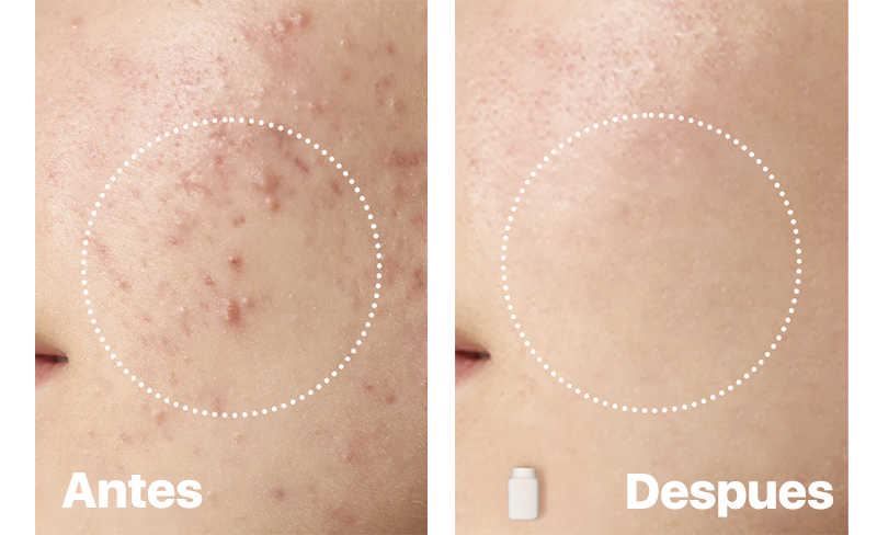 BHA 2% Gentle Exfoliating Toner Anua Ecuador