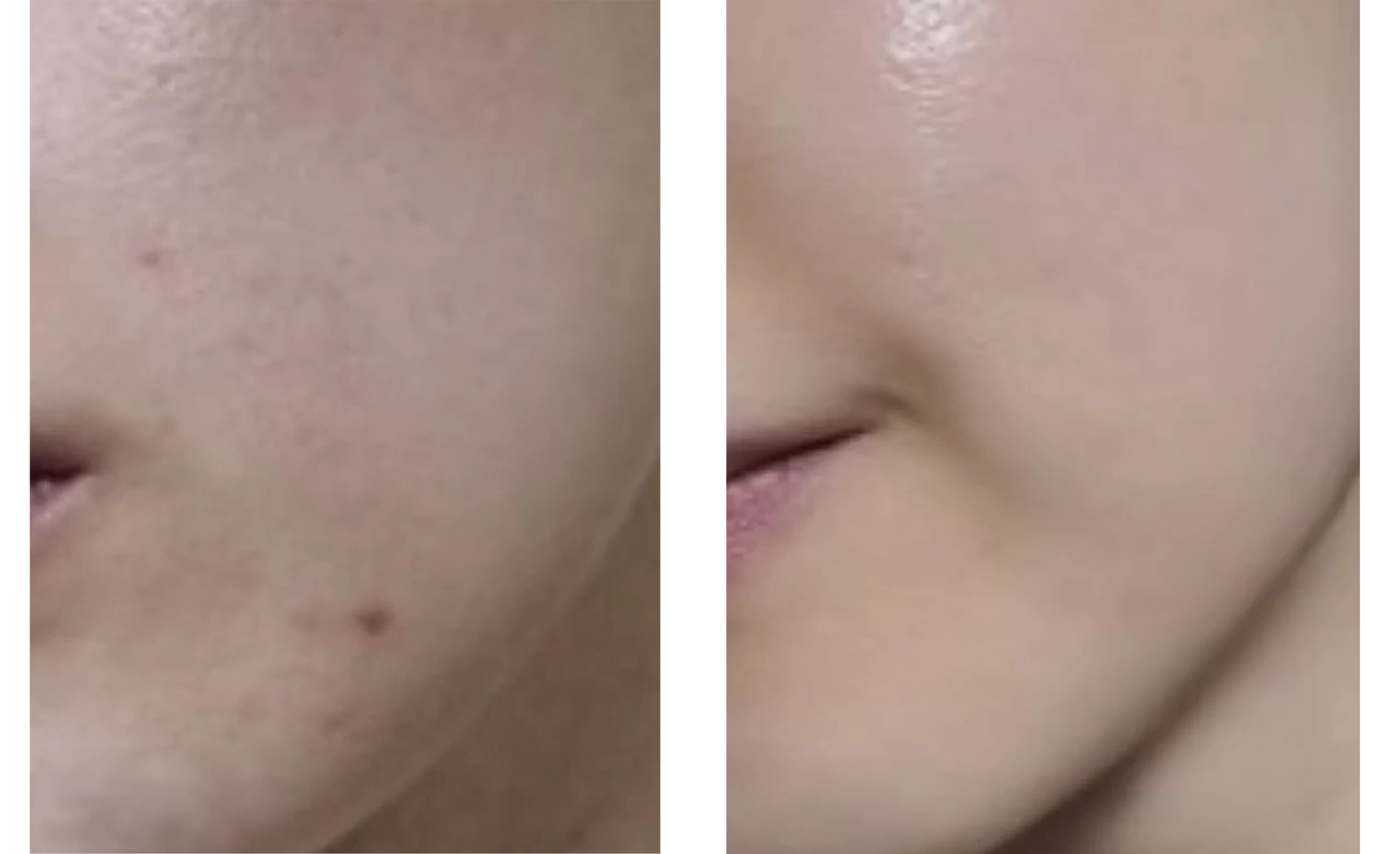 Peach 70% Niacinamide Serum Anua Ecuador